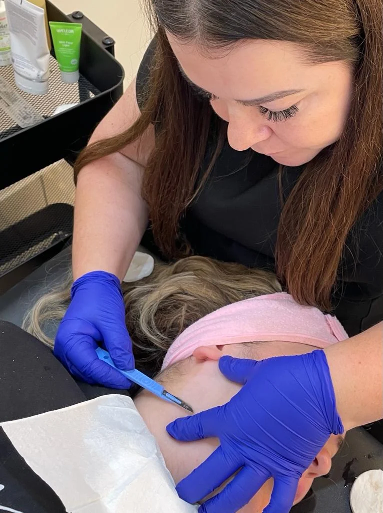 Dermaplaning2